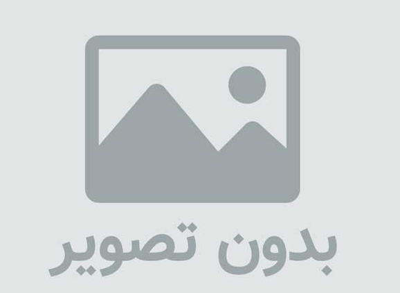 ترندهای جدید ایمپلنت دندان